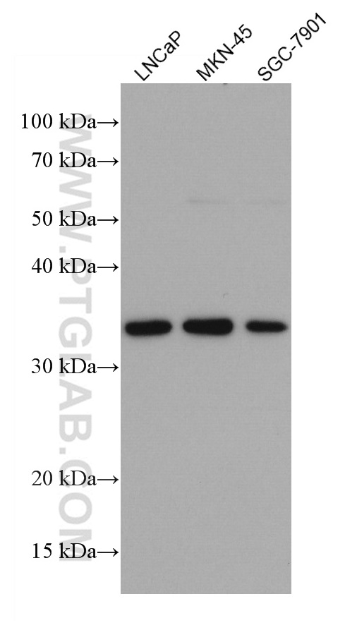 FRZB Monoclonal antibody