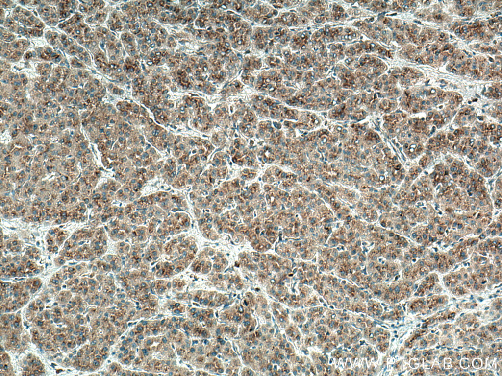 SDC2 Monoclonal antibody