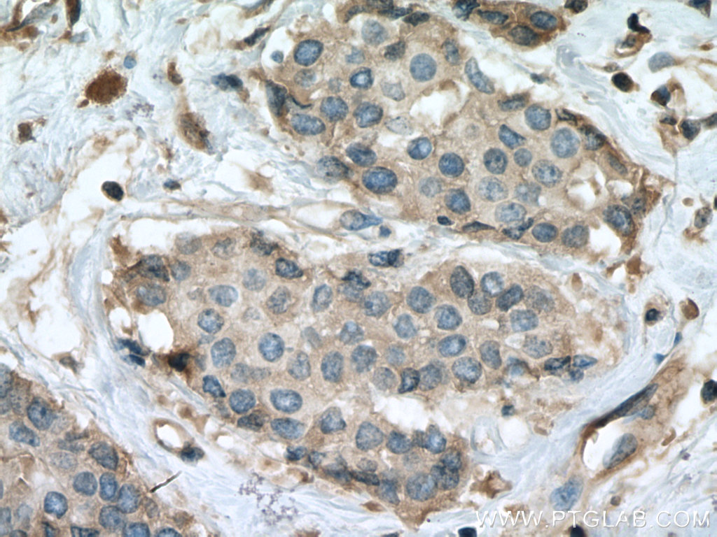 RALA Monoclonal antibody