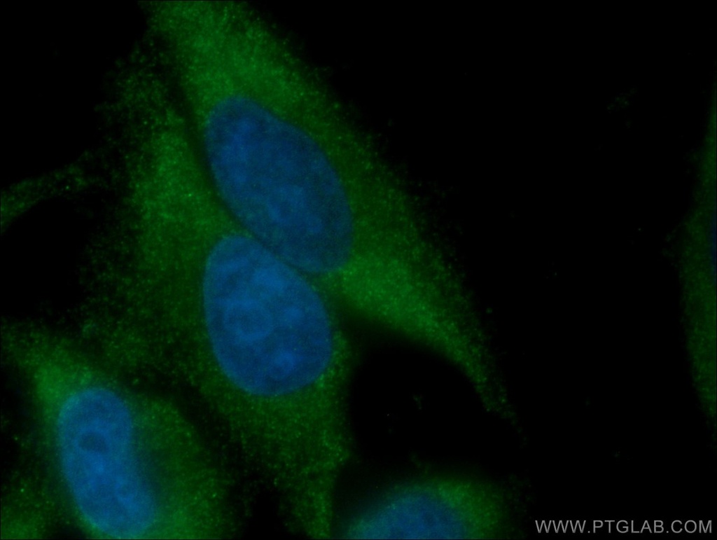 ATG9A Monoclonal antibody