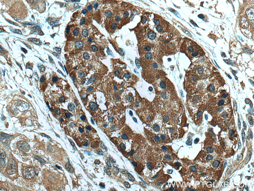 NEU3 Monoclonal antibody