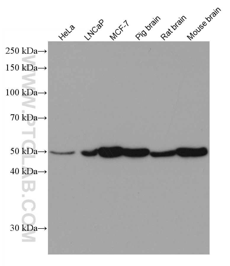 PICK1 Monoclonal antibody