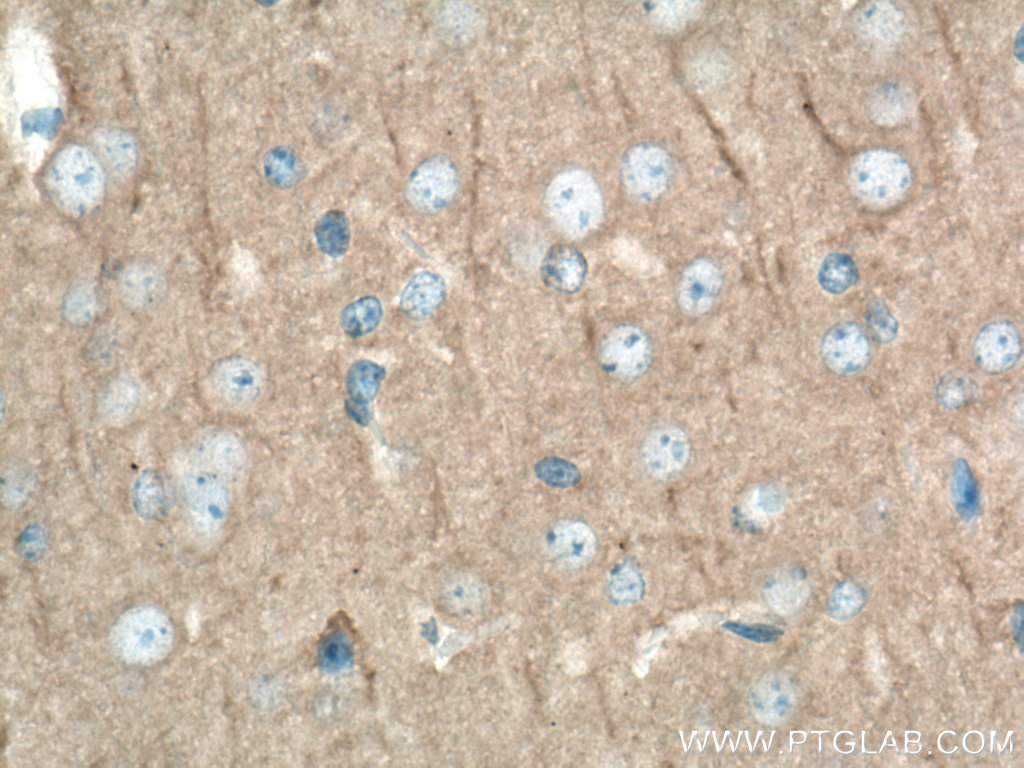 DLG3 Monoclonal antibody