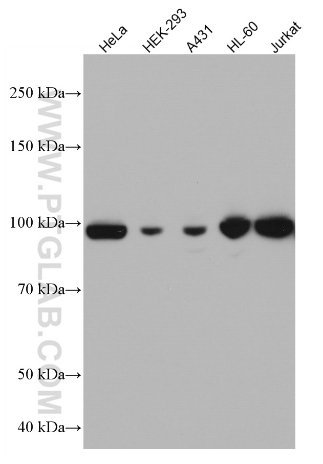 MCM4 Monoclonal antibody