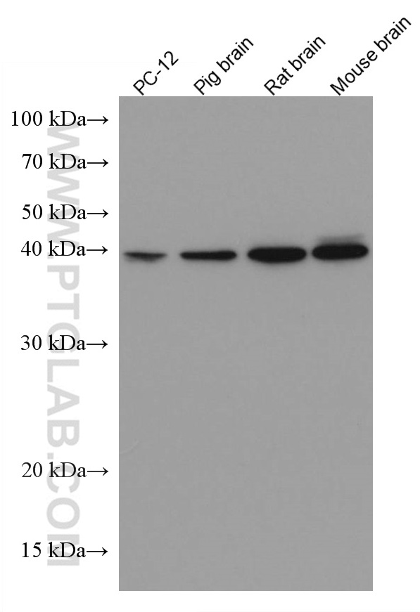 DLX5 Monoclonal antibody