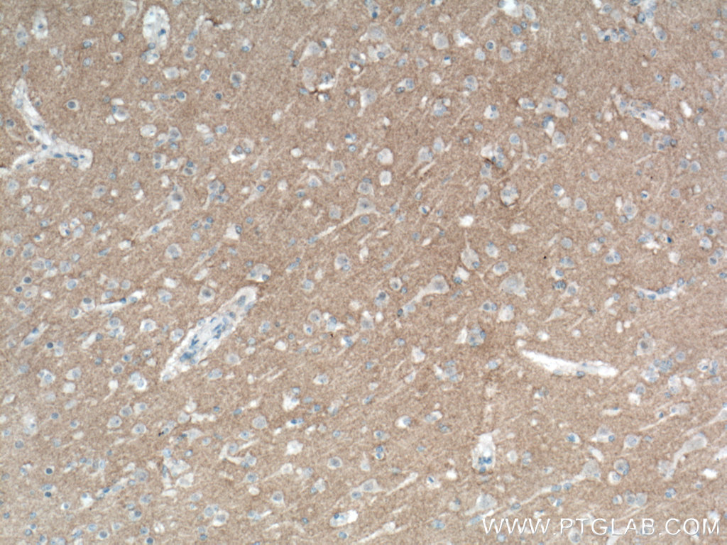 L1CAM Monoclonal antibody