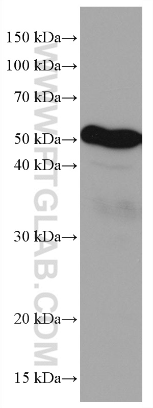LILRB4 Monoclonal antibody