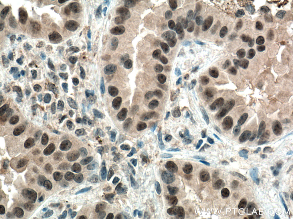 PI3 Kinase p110 Beta Monoclonal antibody