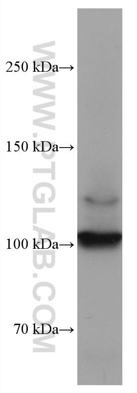 DDR2 Monoclonal antibody
