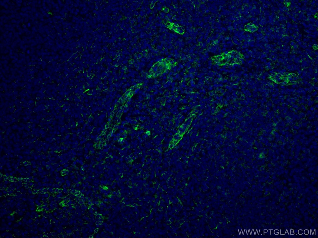 ABCA7 Monoclonal antibody
