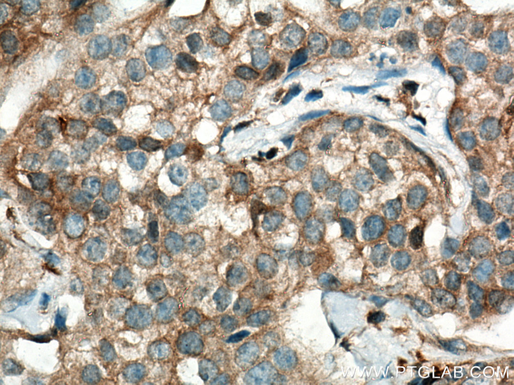 TRIM21 Monoclonal antibody