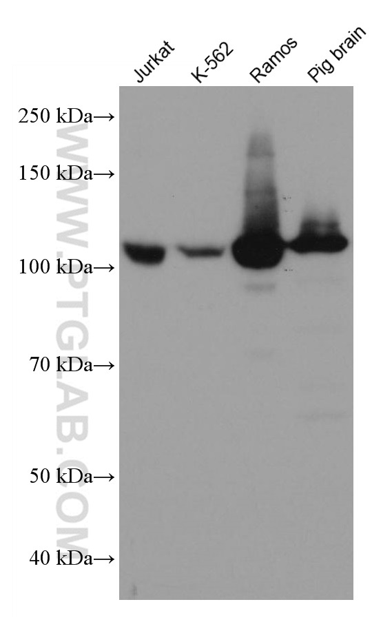 PTK2B Monoclonal antibody