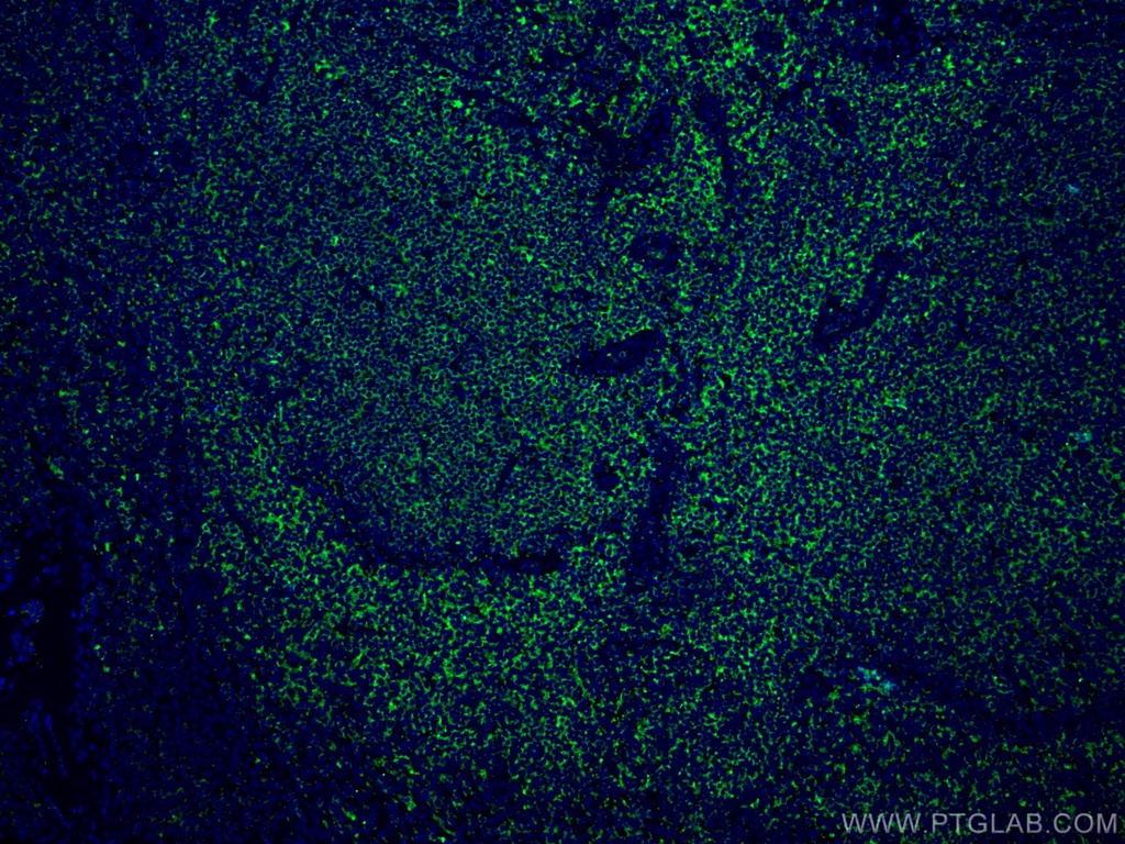 RIAM,APBB1IP Monoclonal antibody