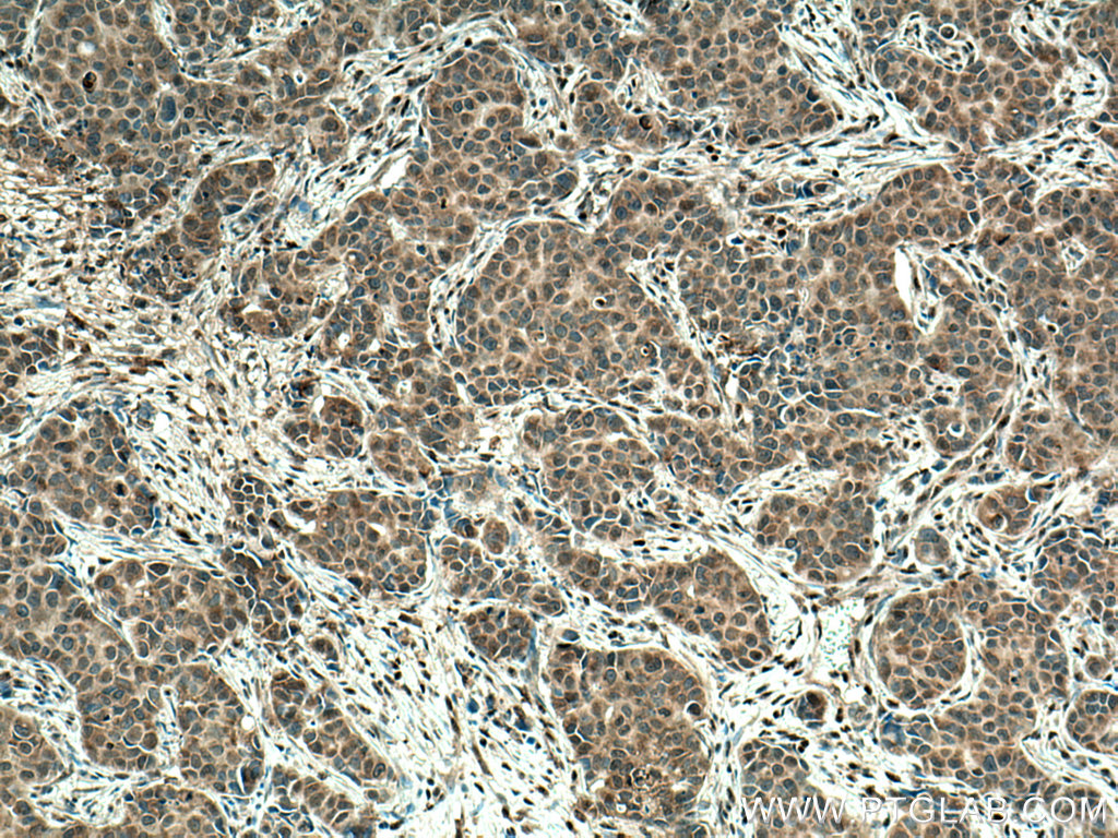 URG4 Monoclonal antibody