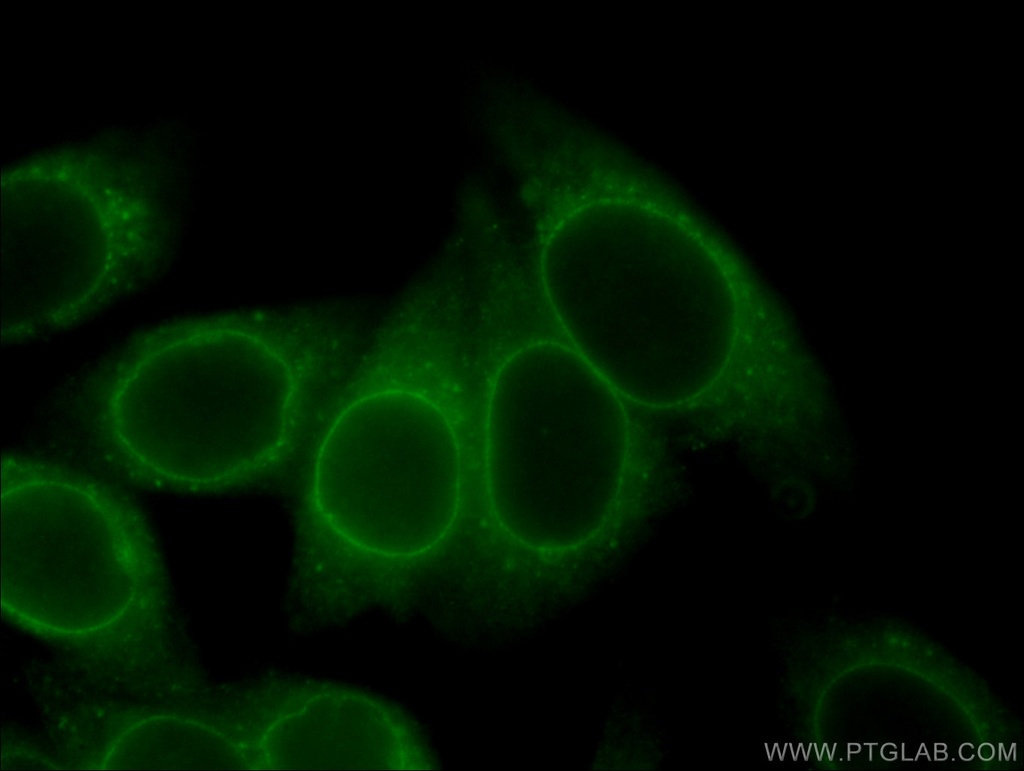 RANGAP1 Monoclonal antibody