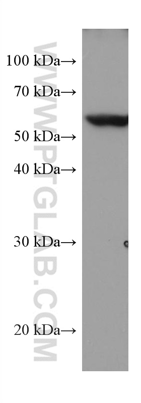 TROVE2 Monoclonal antibody