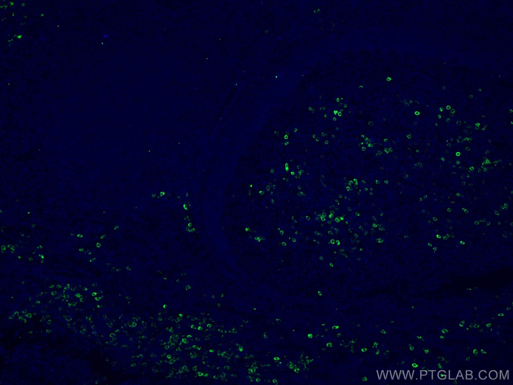 CD138/Syndecan-1 Monoclonal antibody