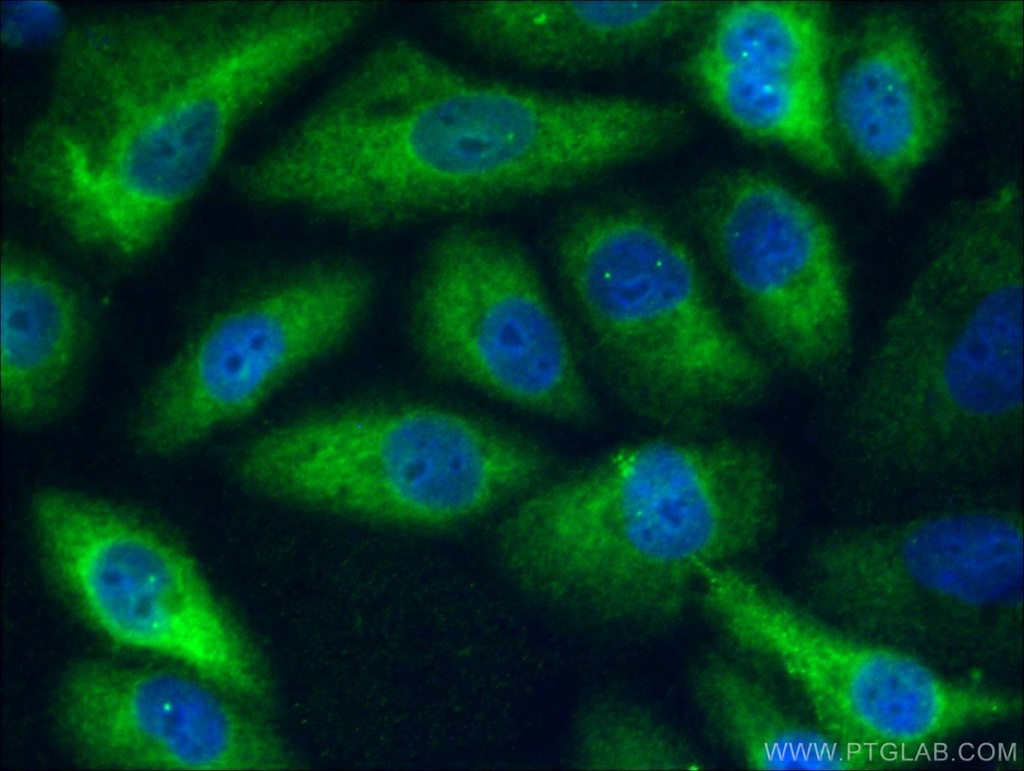 ACLY Monoclonal antibody