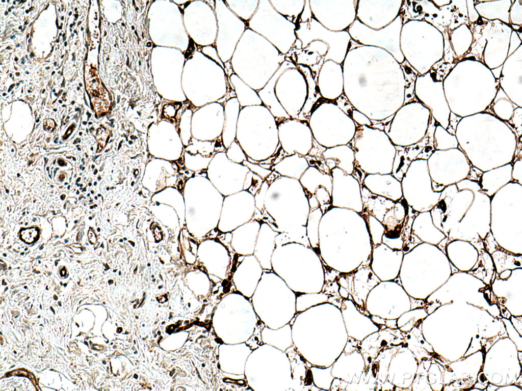 FABP4 Monoclonal antibody