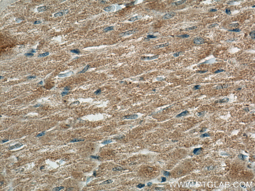 FBXO32 Monoclonal antibody