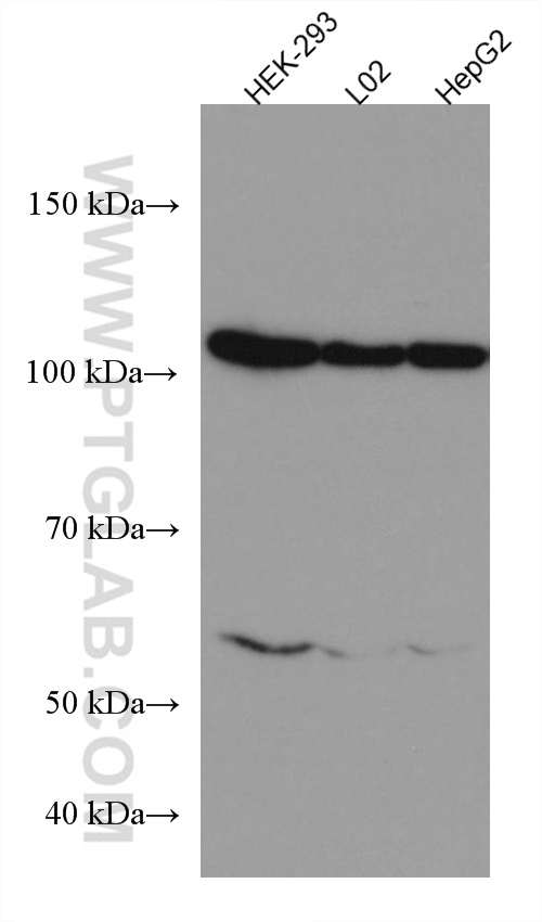 HSPA4 Monoclonal antibody