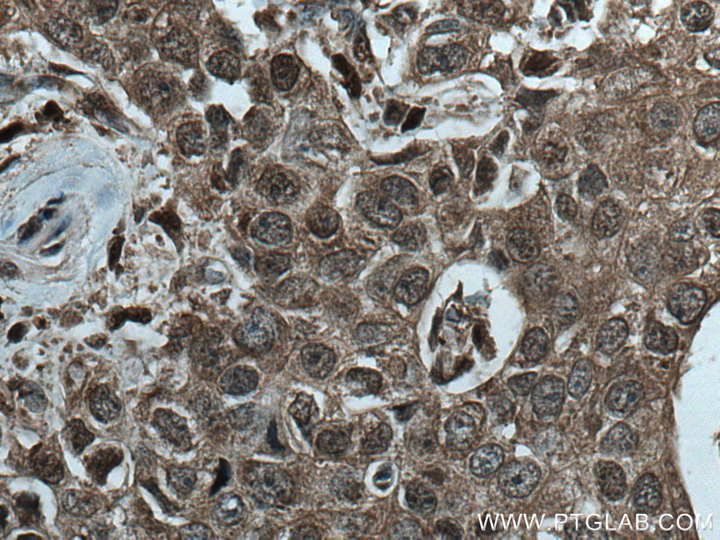 CUL2 Monoclonal antibody
