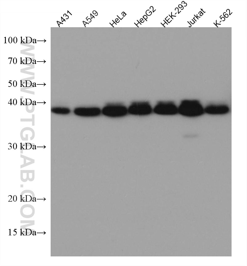 SHARPIN Monoclonal antibody