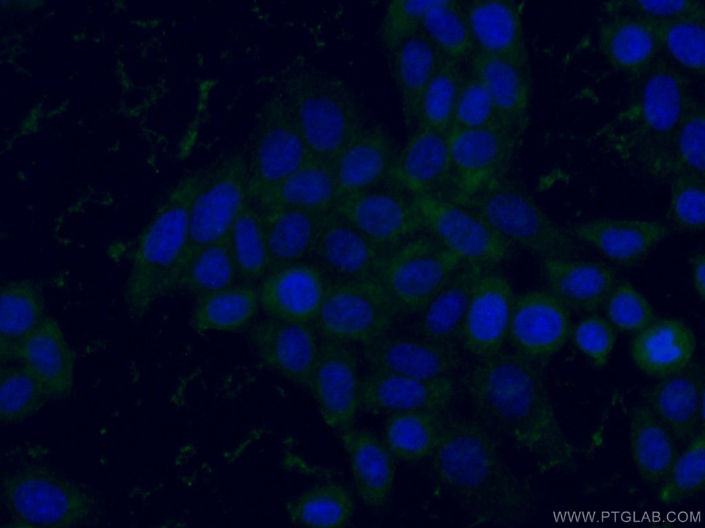 GPI Monoclonal antibody