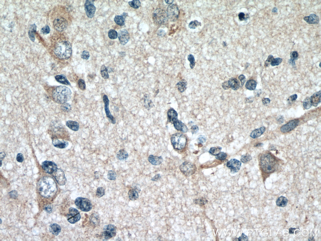 GAS1 Monoclonal antibody
