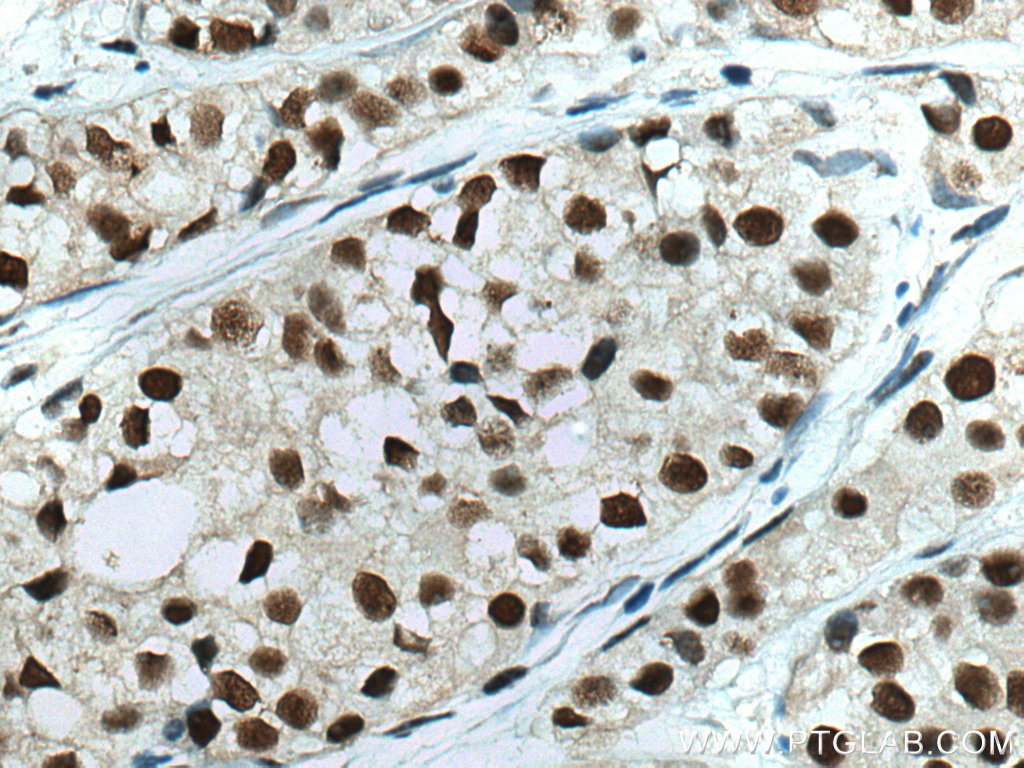 HSF1 Monoclonal antibody