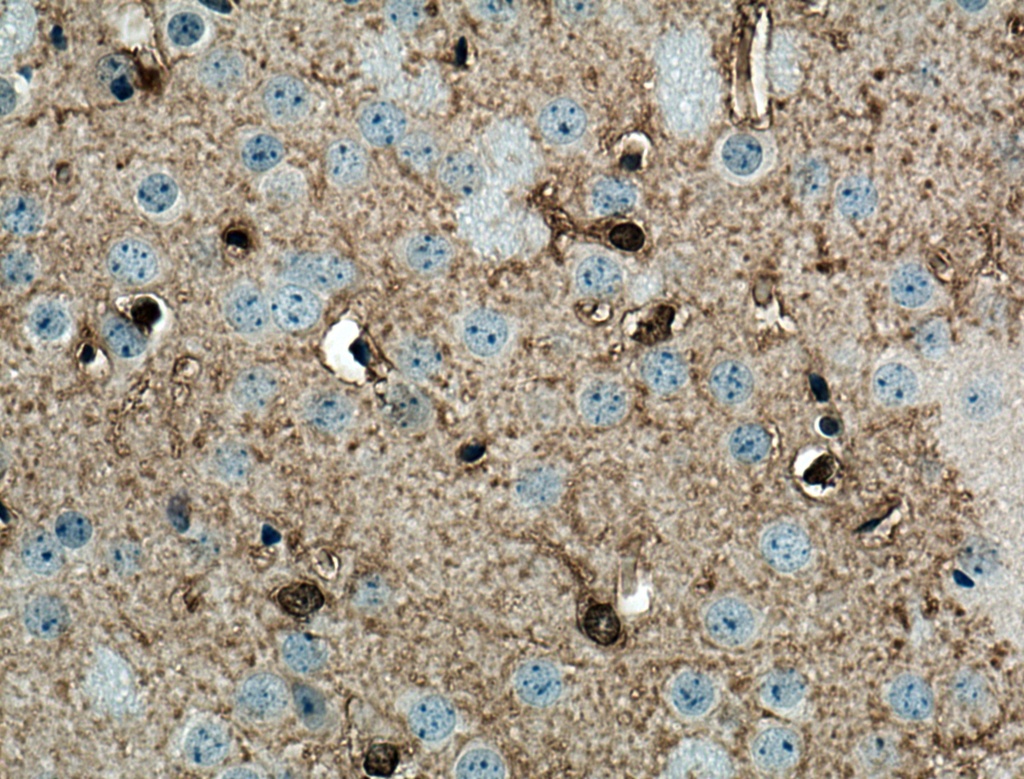 NDRG2 Monoclonal antibody