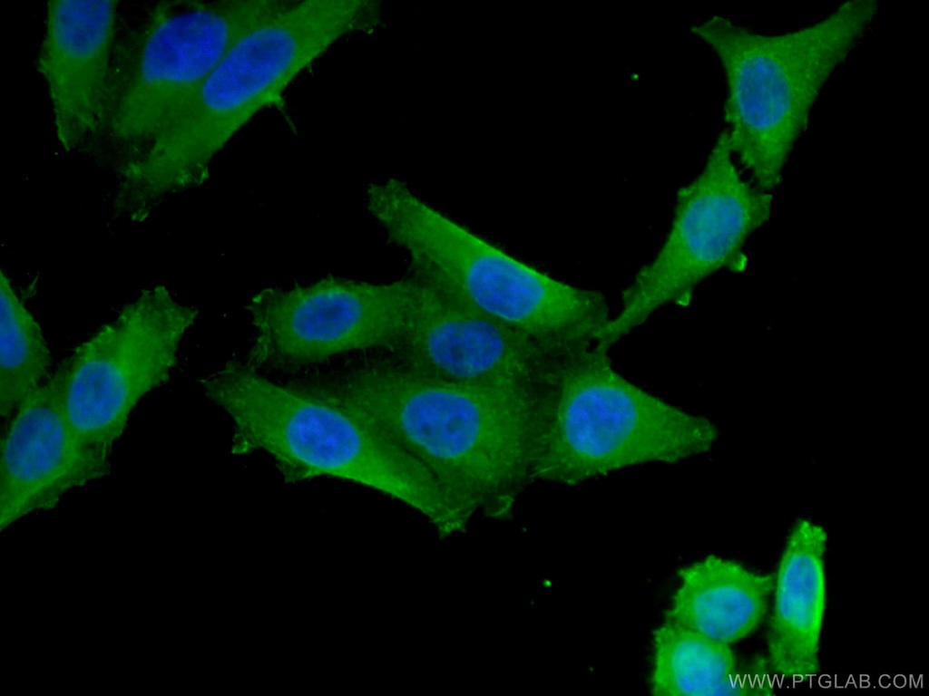 VDR Monoclonal antibody