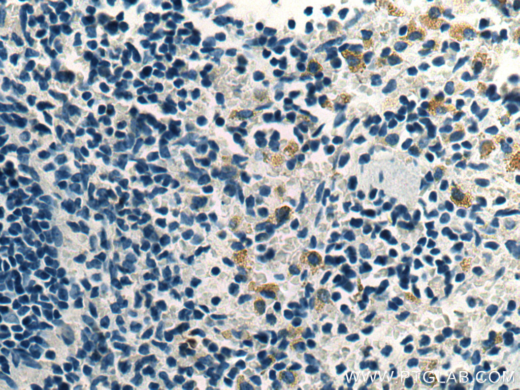 UNC13D Monoclonal antibody