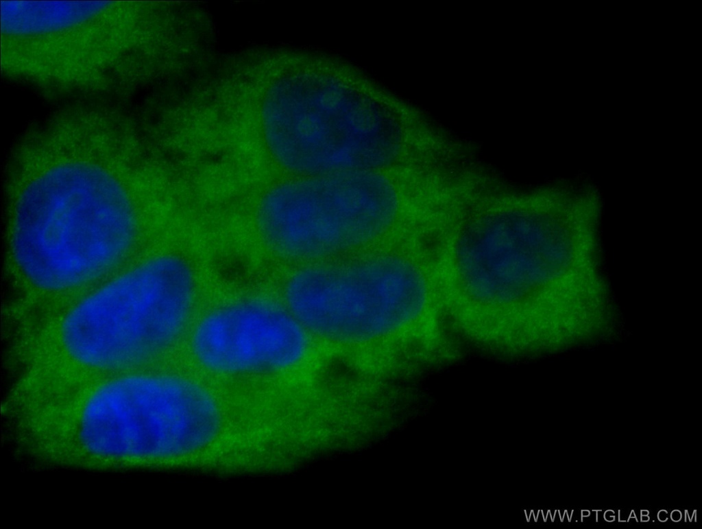 SBDS Monoclonal antibody