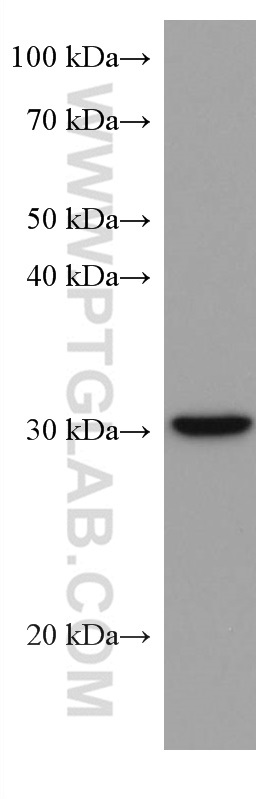 PITX2 Monoclonal antibody