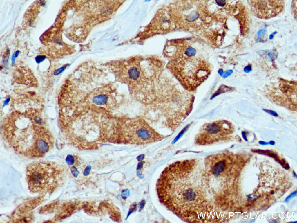 PEPD Monoclonal antibody
