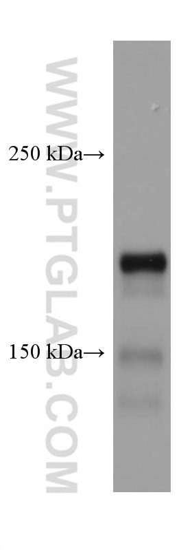 DCC-Specific Monoclonal antibody
