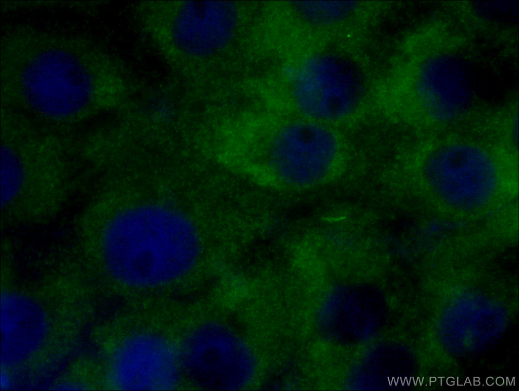 STMN2 Monoclonal antibody