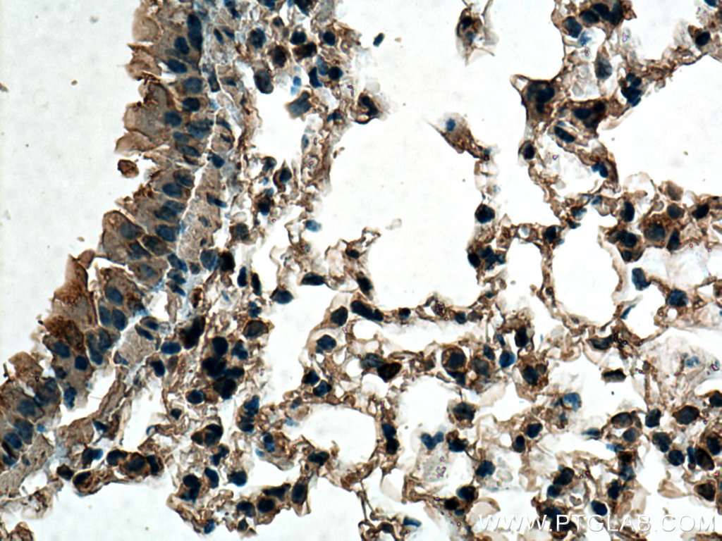 TMEM111 Monoclonal antibody