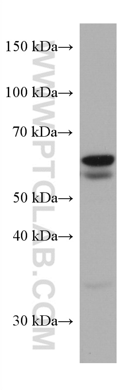 SQLE Monoclonal antibody