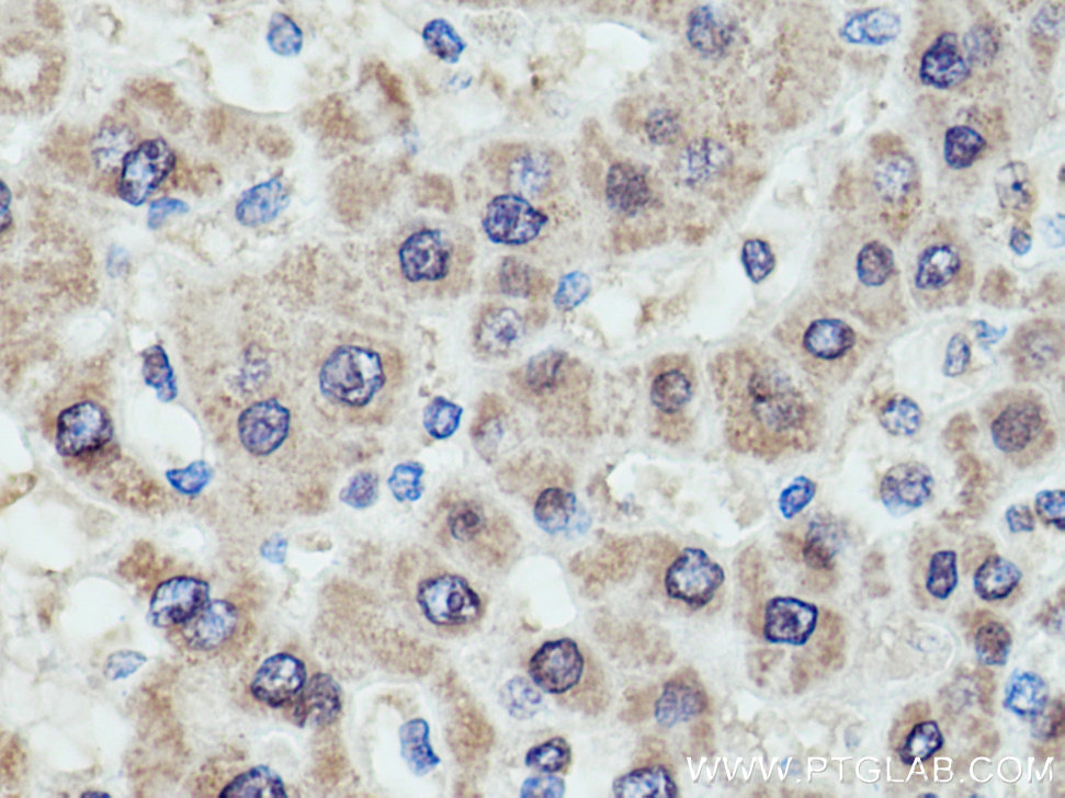 GCK Monoclonal antibody
