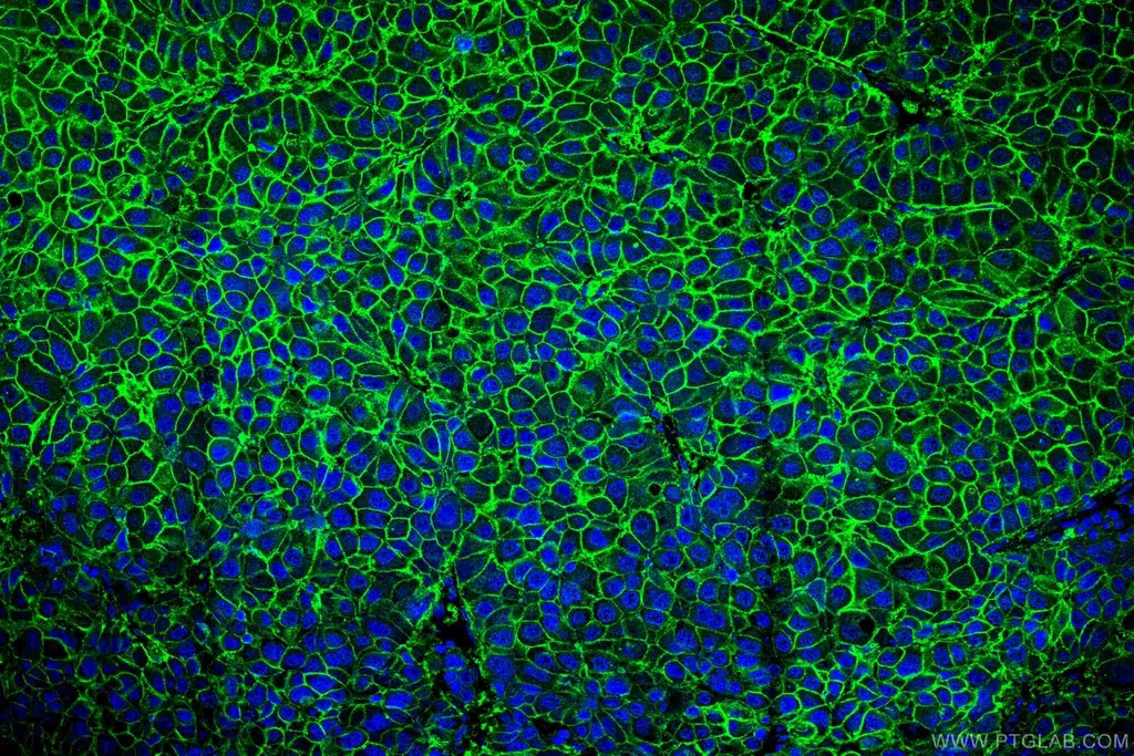 SLC31A1 Monoclonal antibody