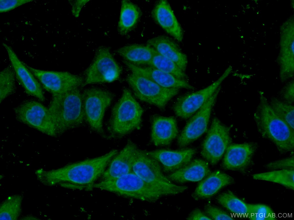 RPL17 Monoclonal antibody