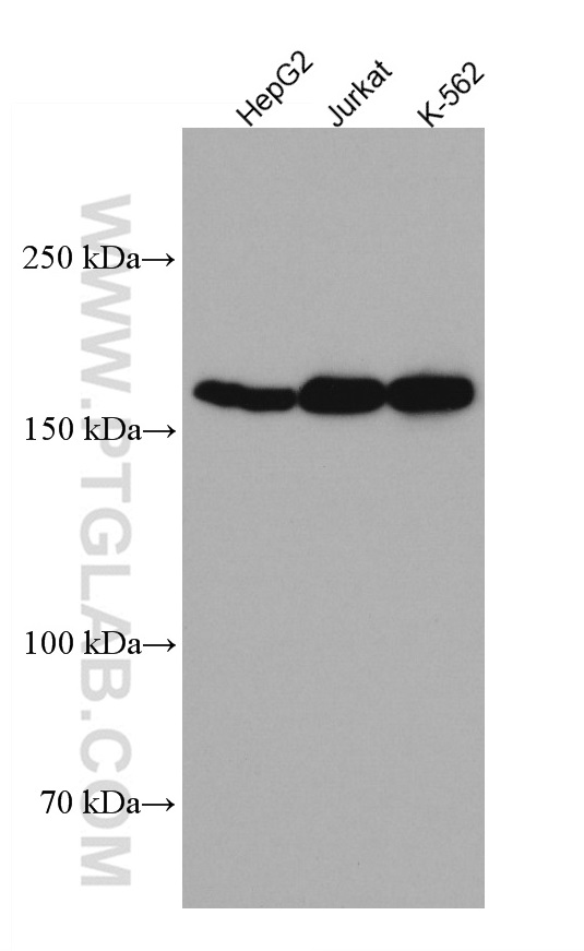 Thrombospondin 1 Monoclonal antibody