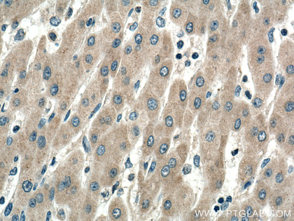 SIRT5 Monoclonal antibody