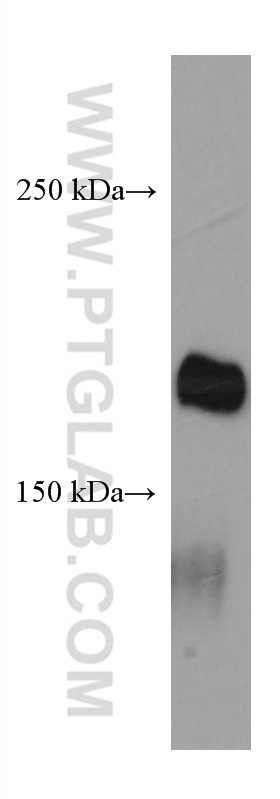 LAMC3-Specific Monoclonal antibody