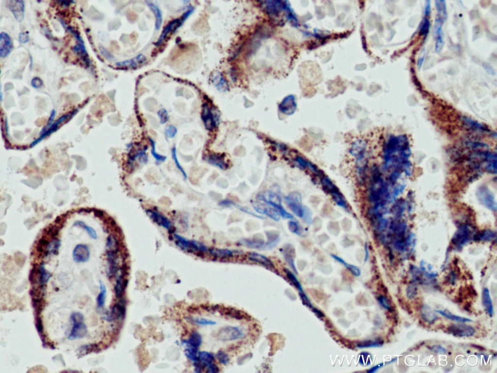 CYP11A1 Monoclonal antibody