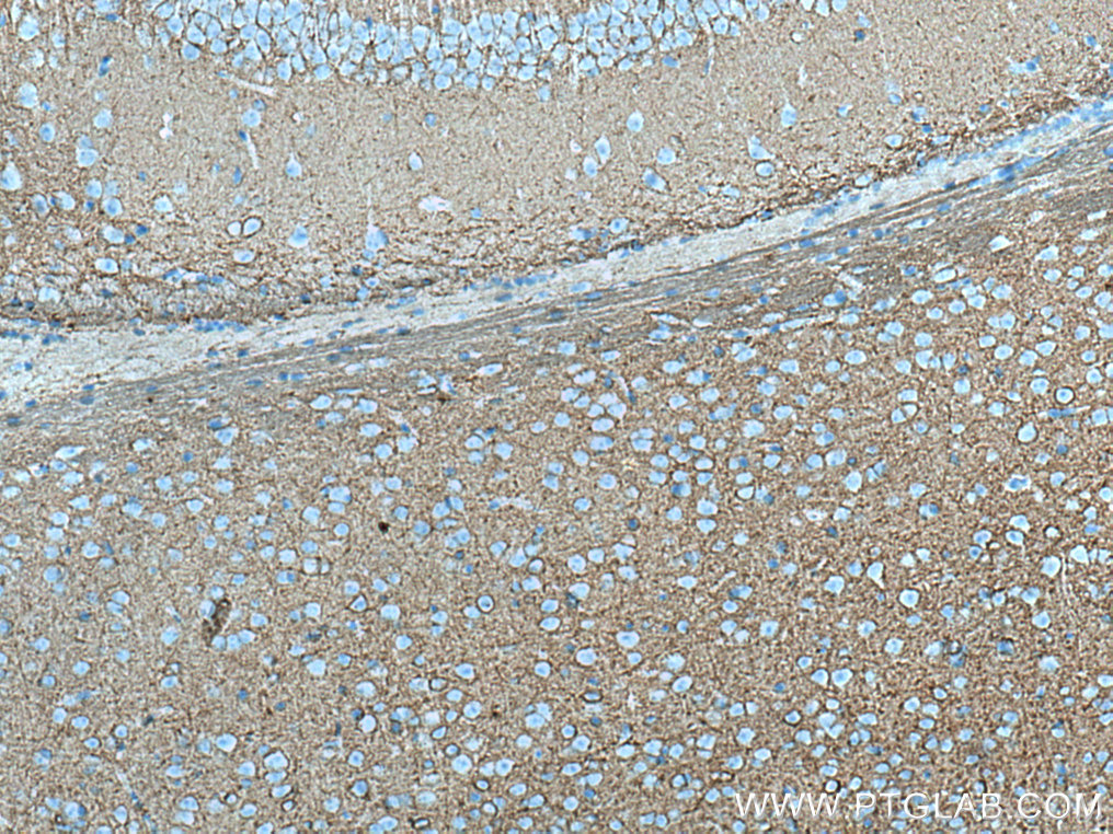 PLXNB2 Monoclonal antibody