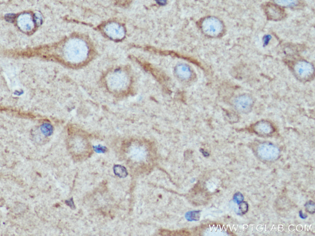 TRIM9 Monoclonal antibody