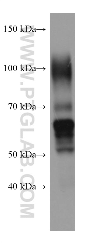 PSG1 Monoclonal antibody